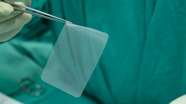 Best Lawyer for Hernia Mesh Lawsuit: Why Should You Contact One 