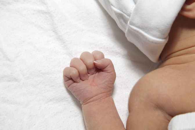 Newborn Shoulder Dystocia: Complications and Management